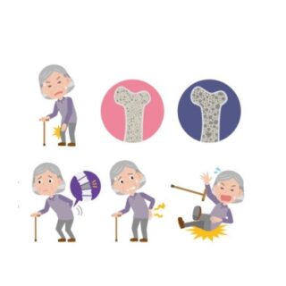 رسم توضيحي لامرأة مسنة تشعر بآلام عظمية