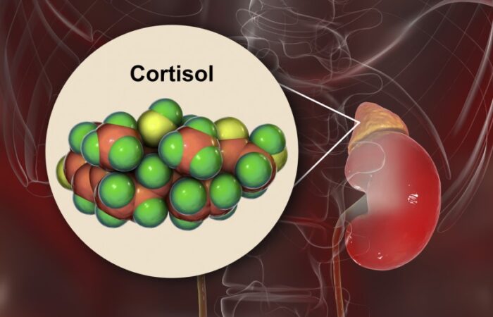 رسم توضيحي لكلية الإنسان وبجانبها كرات مجتمعة خضراء وصفراء اللون وفوقها كلمة كورتيزول مكتوبة بالإنكليزي