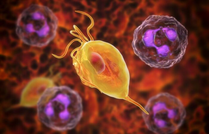 داء المشعرات على شكل كيس صغير أصفر اللون في وسط أحمر