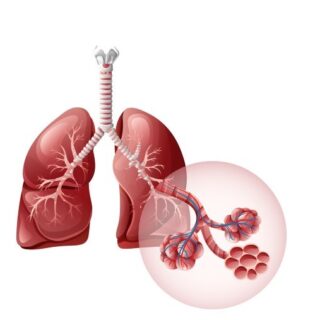 رسم توضيحي لرئة مصابة بانسداد الشعب الرئوية