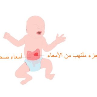 طفل رضيع يبكي