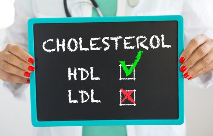 لوح أسود مكتوب عليه بالإنكليزية كلمة cholesterol وتحتها مكتوب رمز HDL بالإنكليزية وبجانبه إشارة باللون الأخضر ورمز LDL وبجانبه إشارة باللون الأحمر