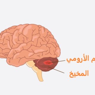 رسم توضيحي لورم موجود داخل المخيخ