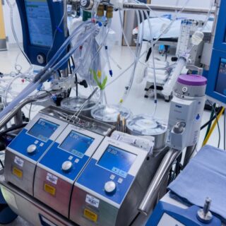 جهاز طبي عليه العديد من شاشات المراقبة وموصل به أنابيب شفافة