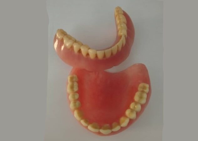 أسنان ضمن جهاز سني متحرك كامل