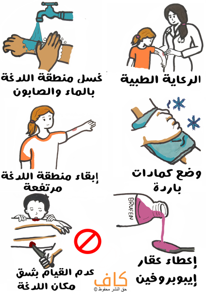 رسم توضيحي لمُمرضة تقوم بفحص يدّ طفلة صغيرة، وشخص يقوم بغسل يده بالمياه بالإضافة لشخص يقوم بوضع كيس مياه بارد على يده