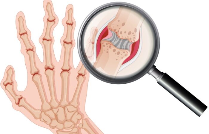 التهاب بأحد أصابع اليد