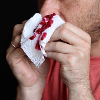 رجل يمسك منديل بين يديه ملوث بالدم موجود على أنفه