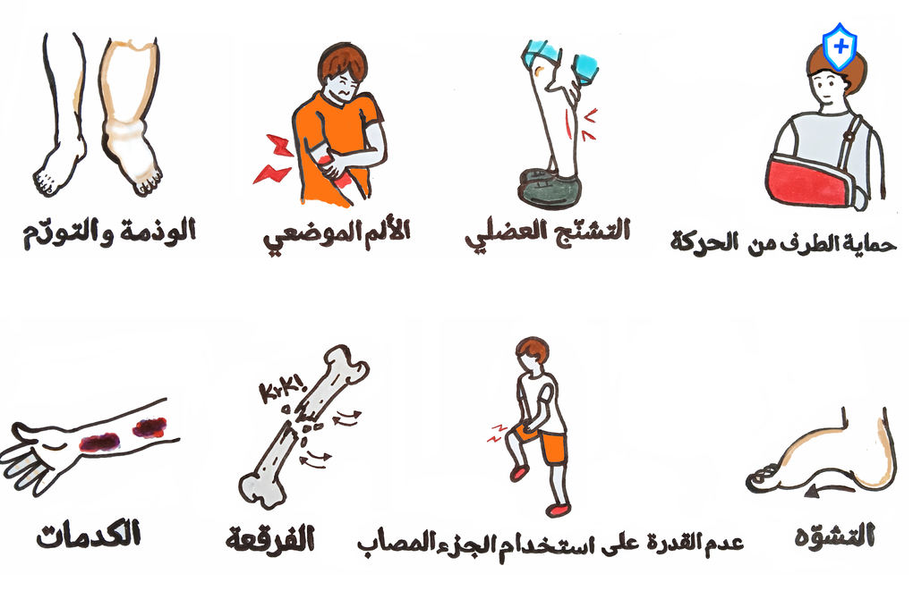 رسم توضيحي لشاب توجد جبيرة على يده وآخر يُمسك بيده التي تنزف وآخر يضع يده على فخذه
