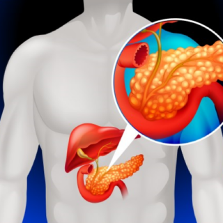رسم توضيحي للبنكرياس ضمن جسم الإنسان