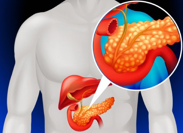رسم توضيحي للبنكرياس ضمن جسم الإنسان