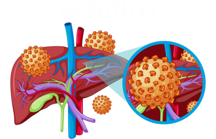 رسم توضيحي للكبد وبجانبه رسم للفيروسات