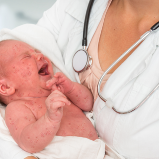 دكتورة تحمل بين ذراعيها رضيع يبكي مصاب بالحصبة الألمانية الخلقية