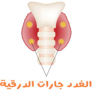 رسم توضيحي للغدد جارات الدرقية في العنق