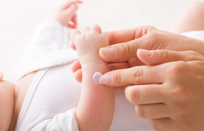 أصابع امرأة تدهن كريم على ذراع رضيع مصاب بطفح جلدي