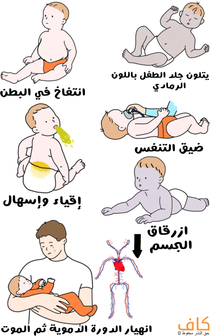 رسم توضيحي لطفل رضيع لونه رمادي في أوضاع مختلفة حيث يبدو مرة مستلقي على بطنه ومرة على ظهره، وطفل رضيع آخر يظهر بطنه منفوخ وطفل آخر يقوم بالاستفراغ