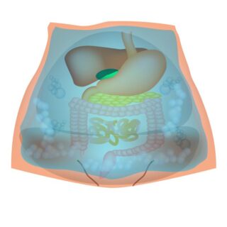 سائل في تجويف البطن يحيط بالكبد والبنكرياس والأمعاء