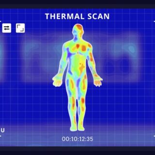 تصوير جسم شخص بالأشعة تحت الحمراء