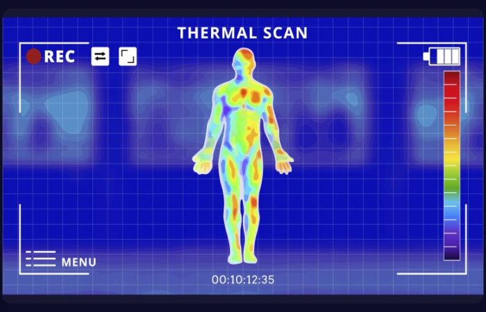 تصوير جسم شخص بالأشعة تحت الحمراء