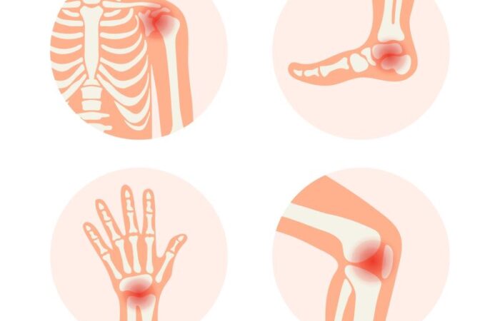 رسم توضيحي لمفصل الكتف ومفصل الدم والركبة