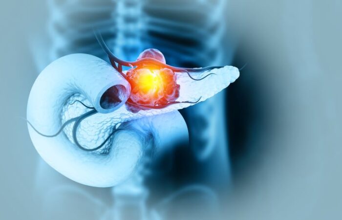 رسم ثلاثي الأبعاد للبنكرياس