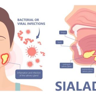 وجه شخص حيث يظهر بأسفل خده تورم بسبب الالتهاب