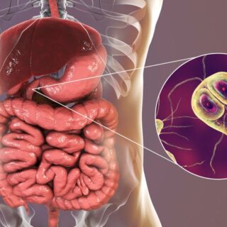 رسم توضيحي لجهاز الهضم عند الإنسان وطفيلي الجيارديا المتمركز في الاثني عشر