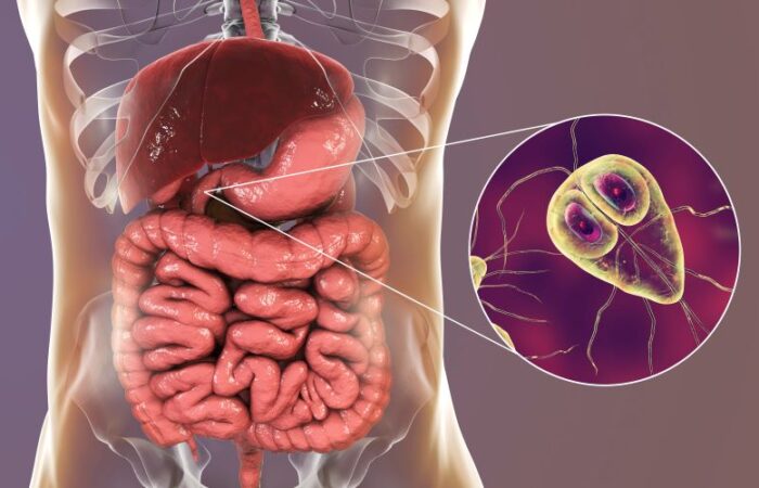 رسم توضيحي لجهاز الهضم عند الإنسان وطفيلي الجيارديا المتمركز في الاثني عشر