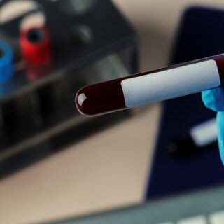 أصابع شخص يرتدي قُفازات زرقاء اللون ويمسك عينة زجاجية تحتوي سائل أحمر