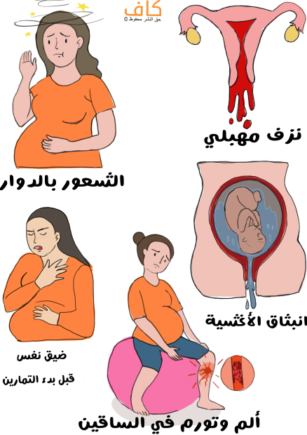رسم توضيحي لرحم أنثوي ينزف دماً، وامرأة حامل يظهر عليها الدوار، وبطن امرأة حامل تخرج المياه من أسفله بالإضافة لامرأة حامل تجلس على كُرة كبيرة وتشعر بألم في قدمها