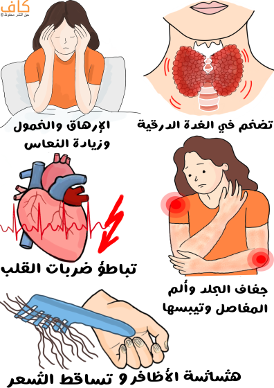 رسم توضيحي للغدة الدرقية في رقبة شخص، وامرأة تجلس في السرير وتضع يديها على رأسها ويظهر التعب عليها، وامرأة تشعر بالألم في مفاصل جسمها وتضع يدها على كوع يدها، بالإضافة لشخص يُمسك بمشط عليه شعر