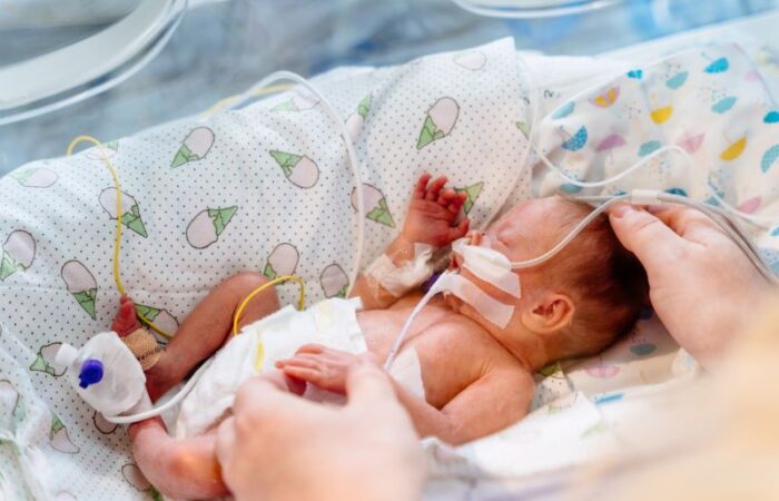 طفل خديج موجود في حضانة المستشفى موصول به العديد من الأسلاك والأنابيب الطبية