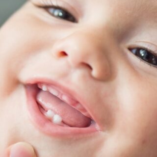 وجه طفل رضيع مُبتسم وتظهر أسنان صغيرة بارزة في فكه السُفلي