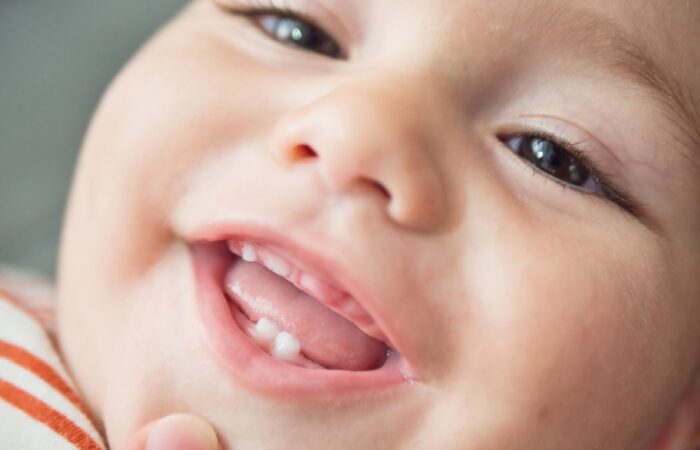 وجه طفل رضيع مُبتسم وتظهر أسنان صغيرة بارزة في فكه السُفلي