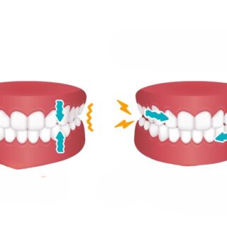 رسم توضيحي للفك العلوي والسفلي للأسنان وهما منطبقان وبجانبهما توجد إشارة لصدور أصوات عنهما في حالة الانطباق