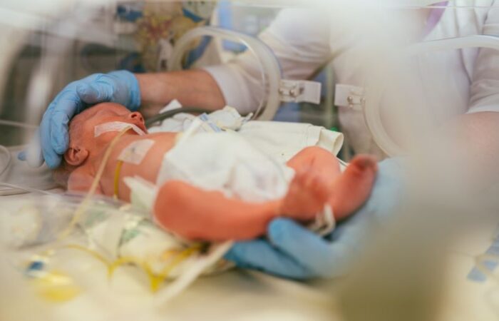 طفل رضيع موصول بأجهزة وأسلاك طبية