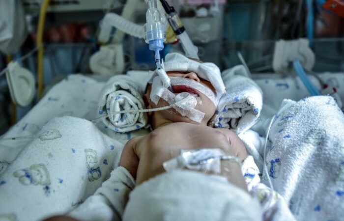 طفل رضيع موصول بأجهزة وأسلاك طبيبة وهو نائم في سرير المستشفى