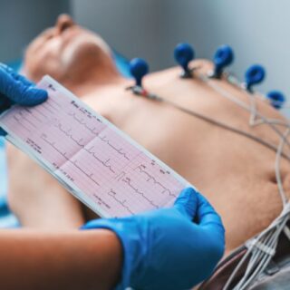 رجل بالغ ممدد على سرير طبي وعلى صدره أسلاك طبيبة وشخص يمسك بورقة تخطيط القلب