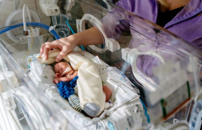 طفل حديث الولادة موصول بأجهزة طبيبة