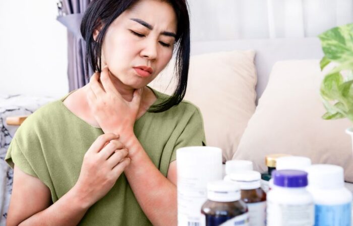 امرأة بالغة يظهر على ساعدها ورقبها احمرار وأمامها مجموعة من الأدوية