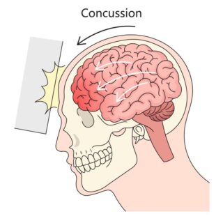رسم توضيحي لدماغ الإنسان