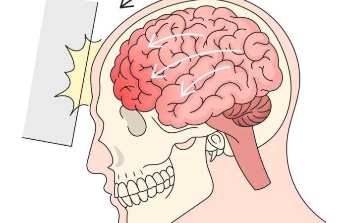 رسم توضيحي لدماغ الإنسان