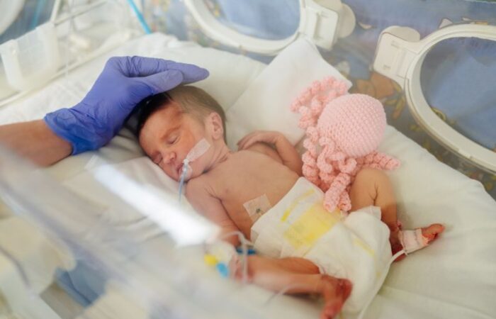 طفل رضيع حديث الولادة في الحاضنة موصول بأجهزة طبية