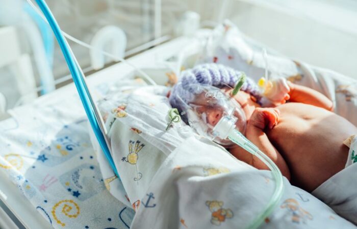 طفل رضيع موصول بأجهزة وأسلاك طبية