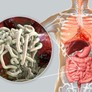 رسم توضيحي لجهاز الهضم عند الإنسان وطفيلي الإسكاريس الخراطينية المتمركز في الأمعاء