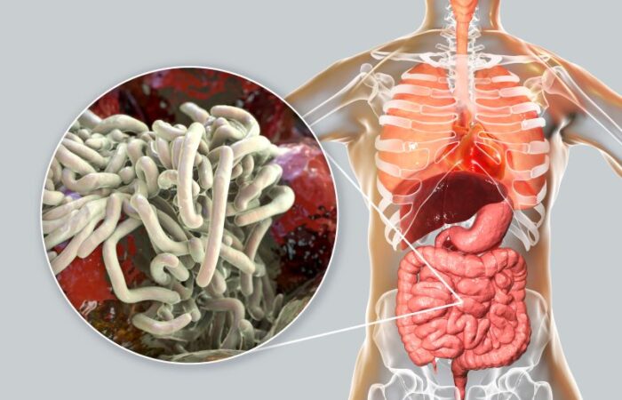 رسم توضيحي لجهاز الهضم عند الإنسان وطفيلي الإسكاريس الخراطينية المتمركز في الأمعاء