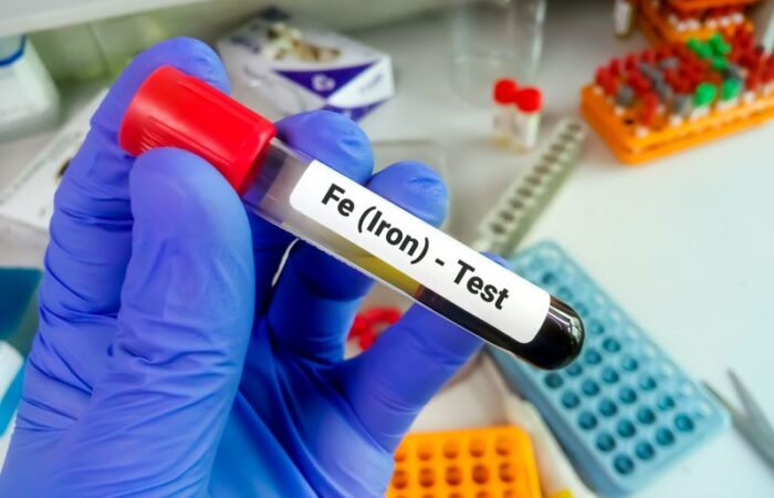 أصابع شخص يرتدي كفوف زرقاء اللون ويمسك أنبوب صغير زجاجي يحتوي على سائل أحمر اللون