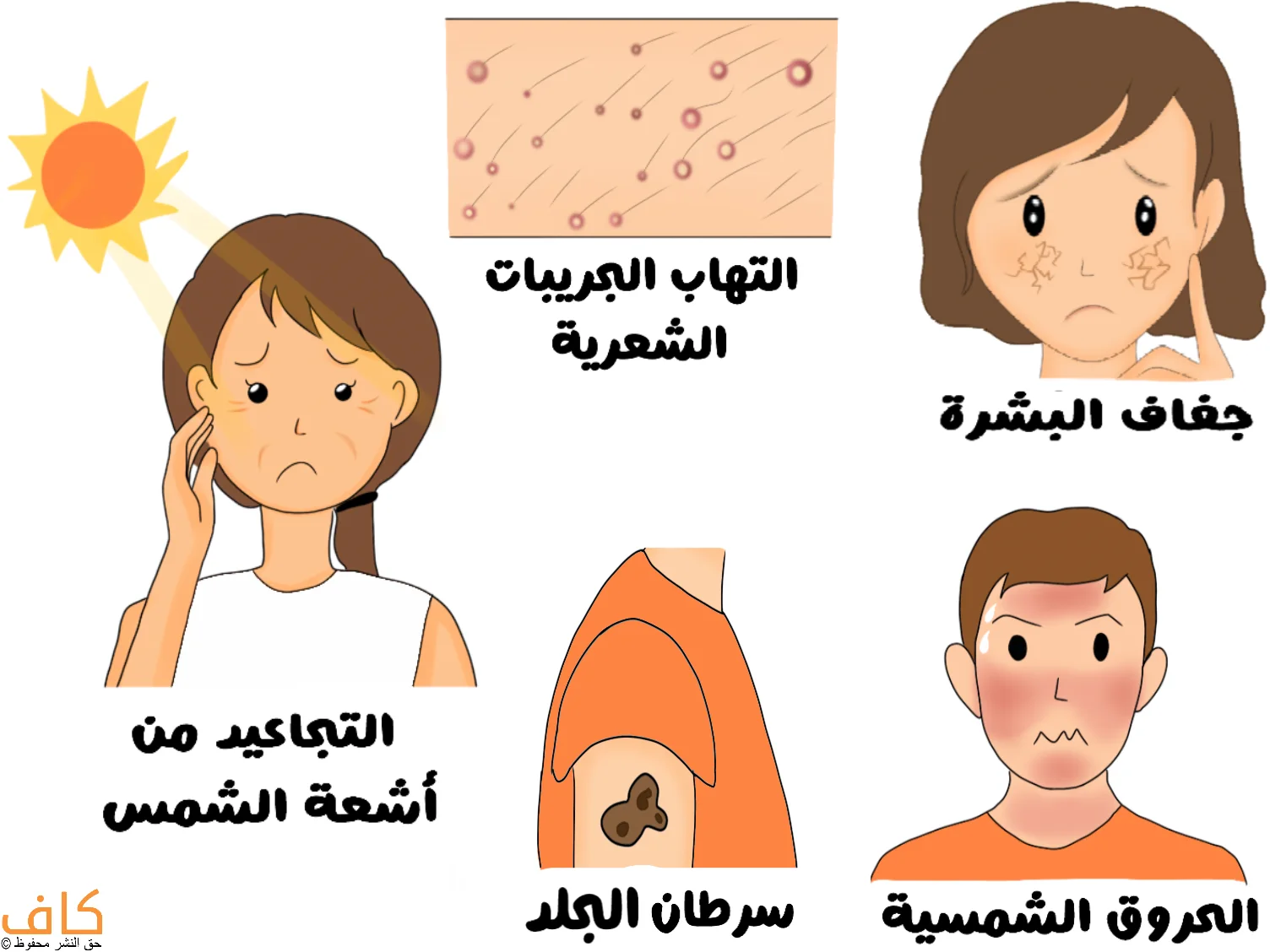 رسم توضيحي يوضح أبرز مشاكل البشرة في الصيف مثل الجفاف، التجاعيد التي تصيب الجلد، الحروق الشمسية، التهاب الجريبات الشعرية، وسرطان الجلد.