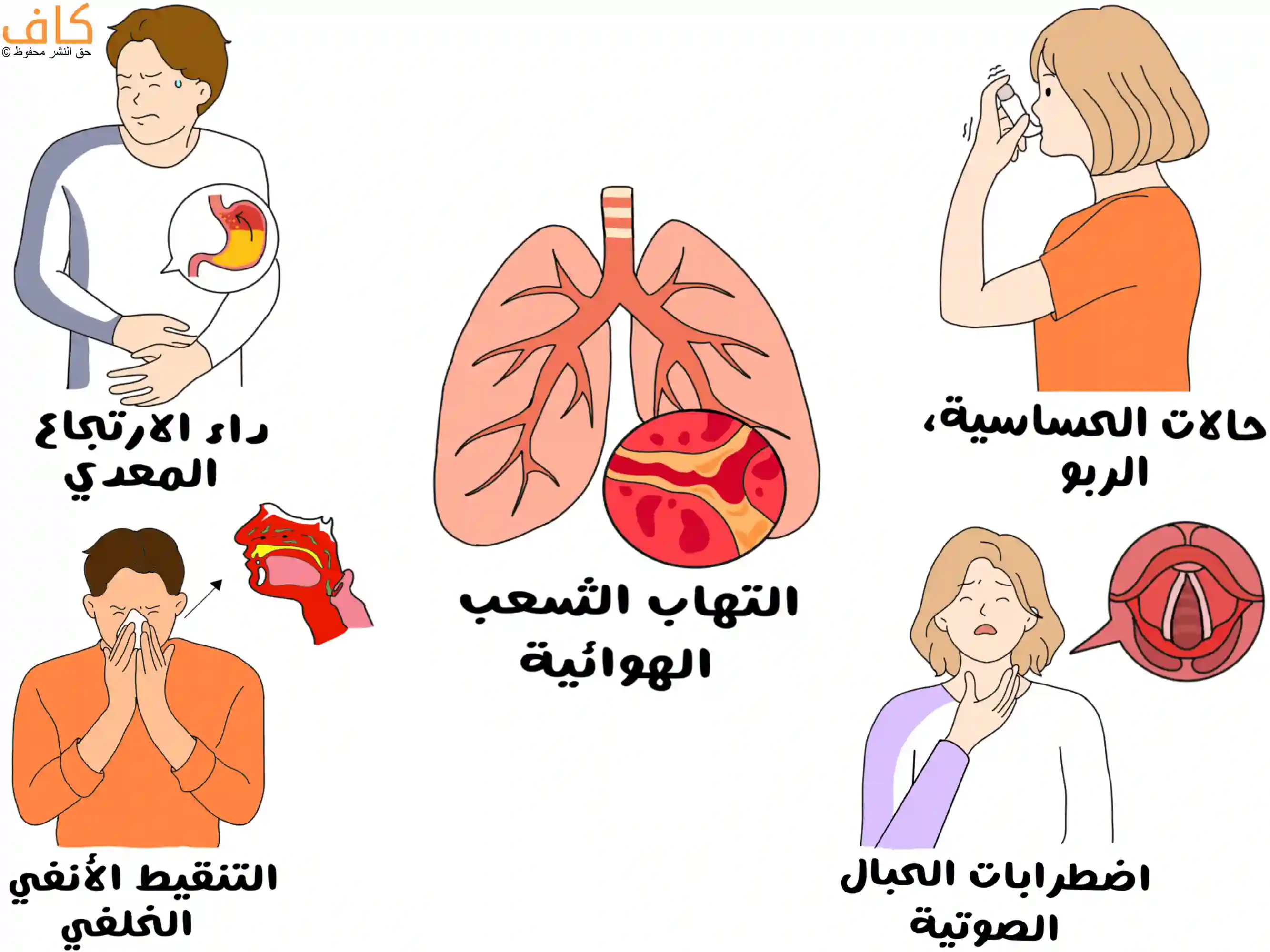 رسم توضيحي يبيّن أسباب السعال المزمن من خلال صور لأشخاص يعانون من الربو، الارتجاع المعدي، التنقيط الأنفي الخلفي، واضطرابات الحبال الصوتية، مع صورة للشعب الهوائية الملتهبة، للتأكيد على تنوع العوامل التنفسية والهضمية المسببة للسعال المستمر.