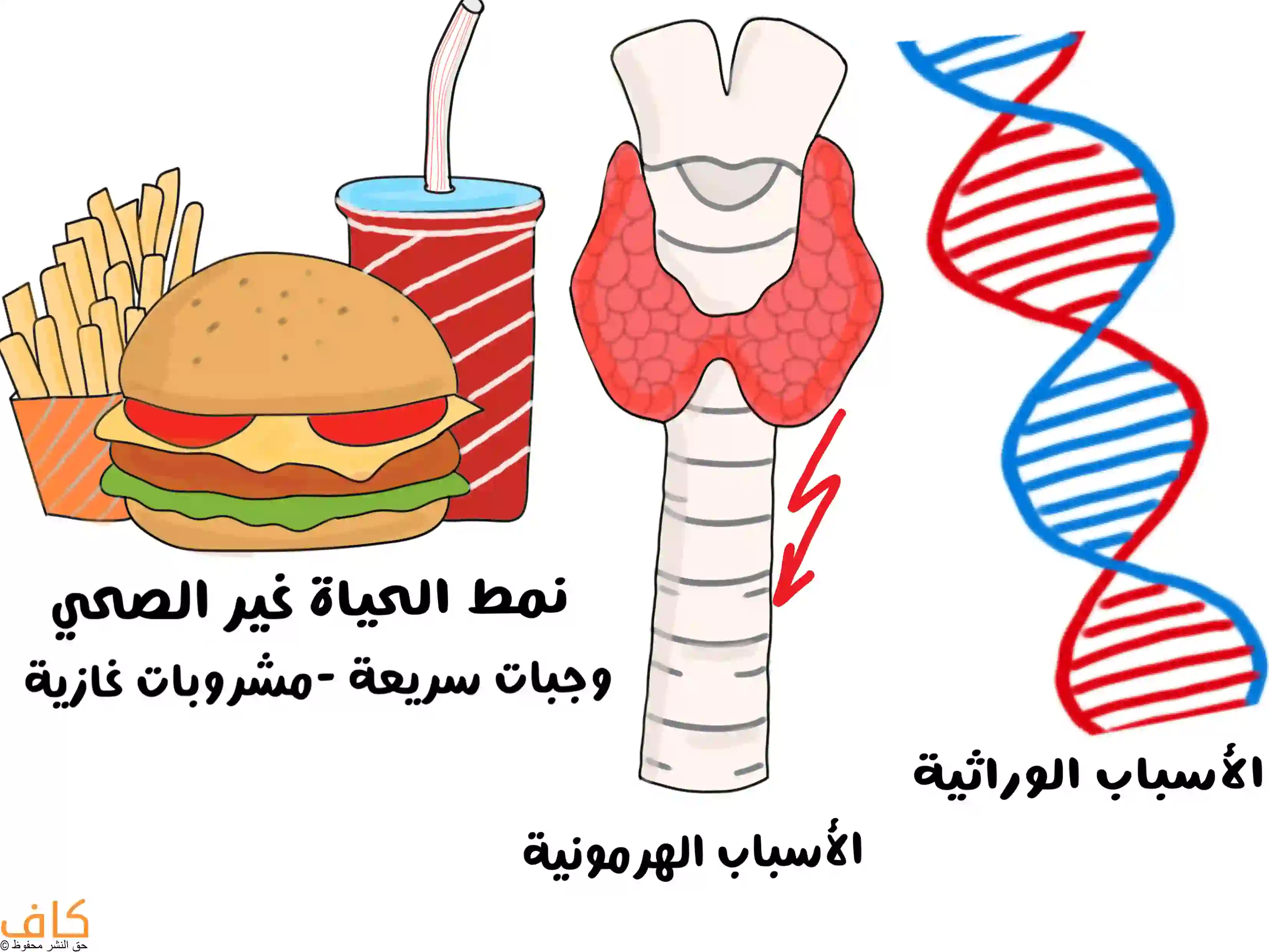 رسمة توضيحية تبيّن أسباب السمنة، حيث يظهر طعام غير صحي مثل البرغر والبطاطس المقلية والمشروبات الغازية كجزء من نمط الحياة غير الصحي، إضافةً إلى صورة الغدة الدرقية لتمثيل الأسباب الهرمونية، ورمز الحمض النووي DNA للتعبير عن الأسباب الوراثية